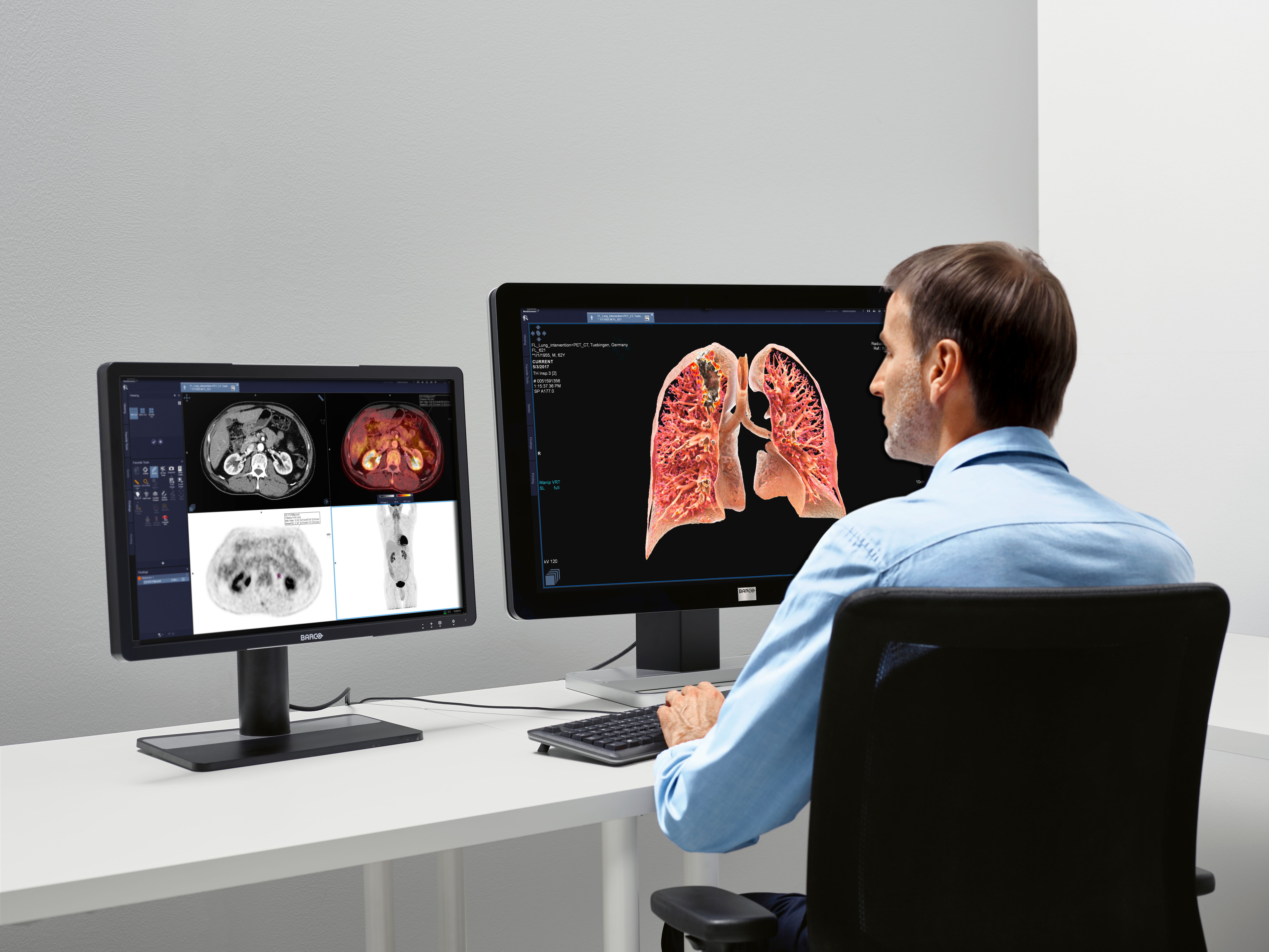 4-IN-THE-LUNG-RUN studie