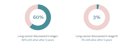 Can lung cancer be treated?